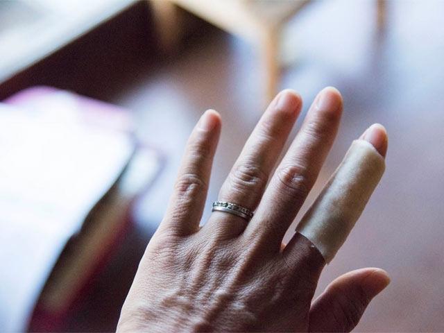 治療した直後の手